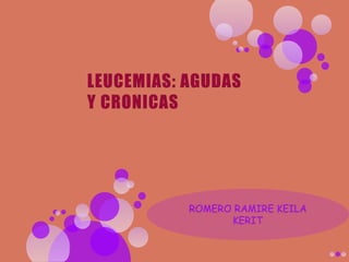 Exposicion leucemias