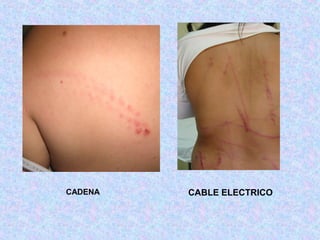 CADENA CABLE ELECTRICO
 