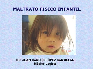 MALTRATO FISICO INFANTIL
DR. JUAN CARLOS LÓPEZ SANTILLÁN
Médico Legista
 