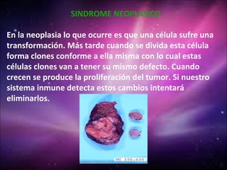 SINDROME NEOPLASICO

En la neoplasia lo que ocurre es que una célula sufre una
transformación. Más tarde cuando se divida esta célula
forma clones conforme a ella misma con lo cual estas
células clones van a tener su mismo defecto. Cuando
crecen se produce la proliferación del tumor. Si nuestro
sistema inmune detecta estos cambios intentará
eliminarlos.
 