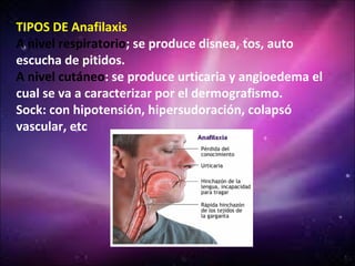 TIPOS DE Anafilaxis
A nivel respiratorio; se produce disnea, tos, auto
escucha de pitidos.
A nivel cutáneo: se produce urticaria y angioedema el
cual se va a caracterizar por el dermografismo.
Sock: con hipotensión, hipersudoración, colapsó
vascular, etc
 