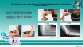Lateral Coyle Method Routine EXPOSICION NOV 2025.pptxd drereffdff dferef | PPTX