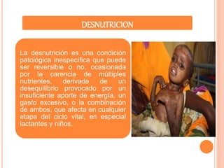 DESNUTRICION 
La desnutrición es una condición 
patológica inespecífica que puede 
ser reversible o no, ocasionada 
por la carencia de múltiples 
nutrientes, derivada de un 
desequilibrio provocado por un 
insuficiente aporte de energía, un 
gasto excesivo, o la combinación 
de ambos, que afecta en cualquier 
etapa del ciclo vital, en especial 
lactantes y niños. 
 