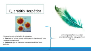 Queratitis Herpética
Existen dos tipos principales de este virus:
El Tipo I que es el más común e infecta principalmente la cara,
causando herpes labial.
El Tipo II es el que se transmite sexualmente e infecta los
genitales.
ambos tipos de herpes pueden
extenderse hasta los ojos y ocasionar
infección
 