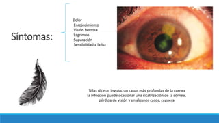 Síntomas:
Dolor
Enrojecimiento
Visión borrosa
Lagrimeo
Supuración
Sensibilidad a la luz
Si las úlceras involucran capas más profundas de la córnea
la infección puede ocasionar una cicatrización de la córnea,
pérdida de visión y en algunos casos, ceguera
 