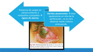 Presencia de sangre en
cámara anterior o
conjuntiva y parpados 
signos de alarma
Heridas penetrantes  área
opalescente en sitio de la
perforación , no es raro
observar tejido iridiano
protuyendo.
 