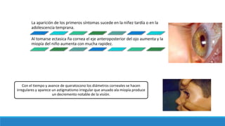 La aparición de los primeros síntomas sucede en la niñez tardía o en la
adolescencia temprana.
Al tomarse ectasica ña cornea el eje anteroposterior del ojo aumenta y la
miopía del niño aumenta con mucha rapidez.
Con el tiempo y avance de queratocono los diámetros corneales se hacen
irregulares y aparece un astigmatismo irregular que anuado ala miopía produce
un decremento notable de la visión.
 