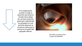 En la exploración
cuando se pide al
paciente que dirija la
mirada hacia abajo
las corneas ectasicas
protruyen indentando
los parpados lo cual
permite observar la
curvatura cónica de la
cornea en el perfil del
parpado inferior.
Este dato se conoce como
el signo de MUNSON
 