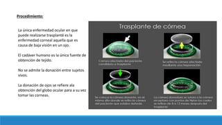 Procedimiento:
La única enfermedad ocular en que
puede realizarse trasplanté es la
enfermedad corneal aquella que es
causa de baja visión en un ojo.
El cadáver humano es la única fuente de
obtención de tejido.
No se admite la donación entre sujetos
vivos.
La donación de ojos se refiere ala
obtención del globo ocular para a su vez
tomar las corneas.
 