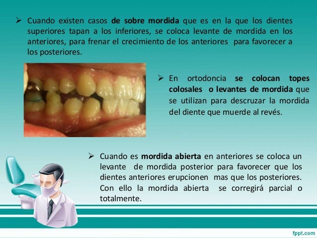 ORTODONCIA