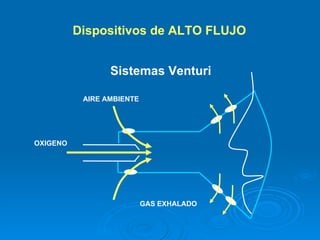 Sistemas Venturi   Dispositivos de ALTO FLUJO   OXIGENO AIRE AMBIENTE GAS EXHALADO 
