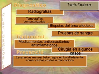 Descamación de las células alveolaresManifestaciones clínicas Son principalmente de tipo respiratorio, como disnea, taquipnea, tos seca al inicio y posteriormente productiva, tiro intercostal y supraesternal, fiebre, anorexia, pérdida de peso, taquicardia y cianosis