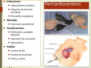 Pericardiocentesis
 Indicaciones:
 Taponamiento cardíaco
 Sospecha de derrame
purulento
 Pericarditis neoplásica
 Abordaje:
 Subcostal, paraesternal
 Complicaciones:
 Perforación cavidades
derechas
 Laceración de coronarias
 Neumotórax
 Análisis
 Conteo de GR
 Conteo de leucocitos
 Gram y cultivo
 