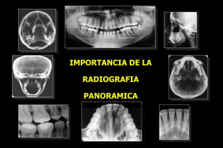 IMPORTANCIA DE LA RADIOGRAFIA PANORAMICA Dr. Daniel Mendoza Alarcón Mail:   [email_address]   