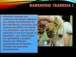 • Infección causada por
protozoos del género Babesia
que atacan los eritrocitos de
los mamíferos y provocan una
anemia hemolítica con fiebre
Los protozoos, que son muy
parecidos a los que causan el
paludismo, son transmitidos
por garrapatas y pueden
causar una infección
oportunista en el hombre.
También se denomina
piroplasmosis
•

 