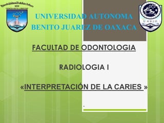 UNIVERSIDAD AUTONOMA
BENITO JUAREZ DE OAXACA
FACULTAD DE ODONTOLOGIA
RADIOLOGIA I
«INTERPRETACIÓN DE LA CARIES »
.
 