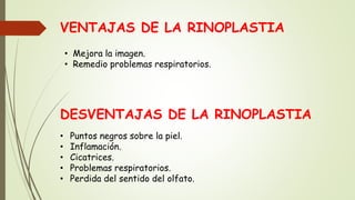 VENTAJAS DE LA RINOPLASTIA
• Mejora la imagen.
• Remedio problemas respiratorios.
DESVENTAJAS DE LA RINOPLASTIA
• Puntos negros sobre la piel.
• Inflamación.
• Cicatrices.
• Problemas respiratorios.
• Perdida del sentido del olfato.
 