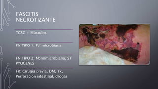 FASCITIS
NECROTIZANTE
TCSC + Músculos
FN TIPO 1: Polimicrobiana
FN TIPO 2: Monomicrobiana, ST
PYOGENES
FR: Cirugía previa, DM, Tx,
Perforacion intestinal, drogas
 