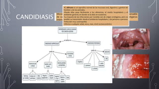 CANDIDIASIS
 