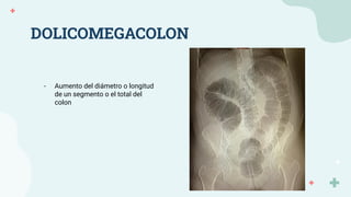 DOLICOMEGACOLON
- Aumento del diámetro o longitud
de un segmento o el total del
colon
 