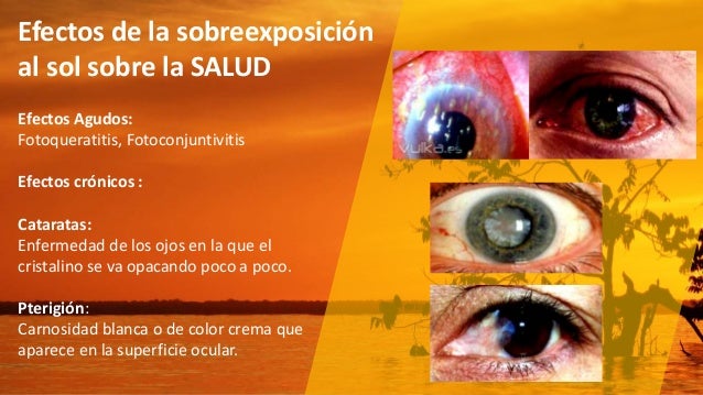 Las pecas sobre la espalda de los hombres