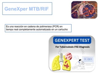 resumen TB pulmonar segun manual el de tb | PPTX