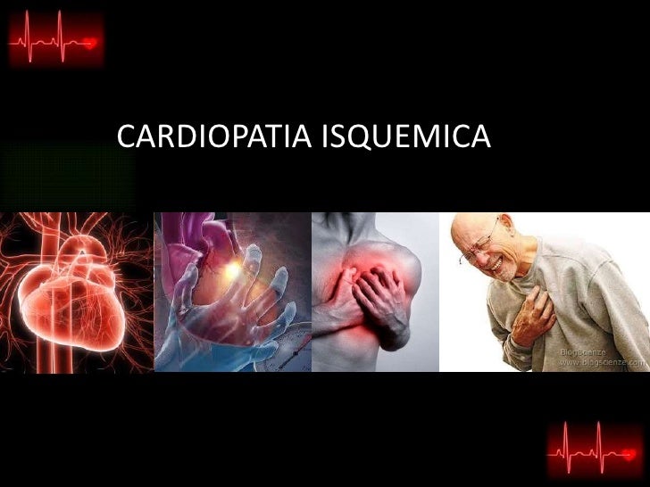 A Fisiopatologia Da Cardiopatia Isquêmica Envolve Especificamente Dois Processos