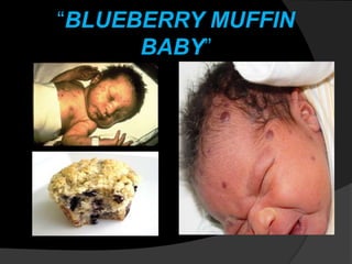 “BLUEBERRY MUFFIN
BABY”
 