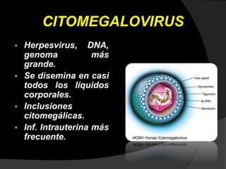 CITOMEGALOVIRUS
 Herpesvirus, DNA,
genoma más
grande.
 Se disemina en casi
todos los líquidos
corporales.
 Inclusiones
citomegálicas.
 Inf. Intrauterina más
frecuente.
 