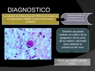 DIAGNOSTICO
La mayoría de infecciones por CMV en la madre no
se diagnostican debido a que provoca pocos
síntomas
Infección previa 
anticuerpos en su
torrente sanguíneo
Shell-vial, Cultivo celular,
PCR.
También se puede
realizar un cultivo de la
garganta o de la orina
de la madre o del bebé
para detectar la
presencia del virus
 