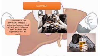 ALCOHOLISMO
El alcoholismo es una
enfermedad en la cual se
padece una fuerte necesidad
de ingerir alcohol etílico, de
forma que existe una
dependencia física del
mismo.
 