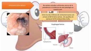 EPIDEMIOLOGÍA BÁSICA No existen estudios suficientes acerca de la
prevalencia e incidencia de esta patología en
nuestro país.
Entre los dos millones de norteamericanos con
cirrosis el 60 % tiene varices, de aquellos sin
varices el 10 % la desarrolla al año.
 