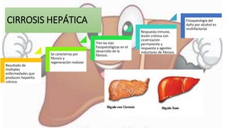 CIRROSIS HEPÁTICA
Resultado de
múltiples
enfermedades que
producen hepatitis
crónica.
Se caracteriza por
fibrosis y
regeneración nodular.
Tres las vías
fisiopatológicas en el
desarrollo de la
fibrosis:
Respuesta inmune,
lesión crónica con
cicatrización
permanente y
respuesta a agentes
inductores de fibrosis.
Fisiopatología del
daño por alcohol es
multifactorial.
 