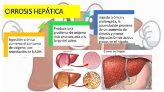 CIRROSIS HEPÁTICA
Ingestión crónica
aumenta el consumo
de oxígeno, por
reoxidación de NADH.
Produce una
gradiente de oxígeno
más pronunciada a lo
largo del acino.
Ingesta crónica y
prolongada, la
acumulación proviene
de un aumento de
síntesis y menor
degradación de ácidos
grasos en el hígado.
 