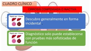 CIRROSIS COMPENSADA O INACTIVA
Descubre generalmente en forma
incidental .
Diagnóstico solo puede establecerse
con pruebas más sofisticadas de
función
CUADRO CLÍNICO
 