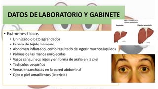DATOS DE LABORATORIO Y GABINETE
• Exámenes físicos:
• Un hígado o bazo agrandados
• Exceso de tejido mamario
• Abdomen inflamado, como resultado de ingerir muchos líquidos
• Palmas de las manos enrojecidas
• Vasos sanguíneos rojos y en forma de araña en la piel
• Testículos pequeños
• Venas ensanchadas en la pared abdominal
• Ojos o piel amarillentos (ictericia)
 