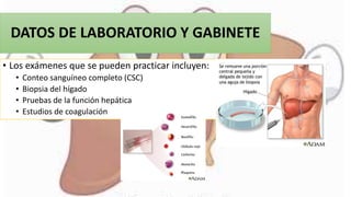 DATOS DE LABORATORIO Y GABINETE
• Los exámenes que se pueden practicar incluyen:
• Conteo sanguíneo completo (CSC)
• Biopsia del hígado
• Pruebas de la función hepática
• Estudios de coagulación
 