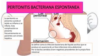 PERITONITIS BACTERIANA ESPONTANEA
La peritonitis se
presenta cuando el
tejido se inflama o se
infecta. Esta
complicación se
presenta
frecuentemente en
pacientes con cirrosis
hepática
Se define como la infección bacteriana del líquido ascítico que se
produce en ausencia de un foco infeccioso intra-abdominal
Por lo bacilos aerobios Gram negativos procedentes de la propia flora
intestinal
 