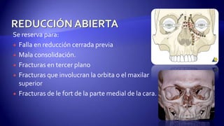 Se reserva para:
 Falla en reducción cerrada previa
 Mala consolidación.
 Fracturas en tercer plano
 Fracturas que involucran la orbita o el maxilar
superior
 Fracturas de le fort de la parte medial de la cara.
 