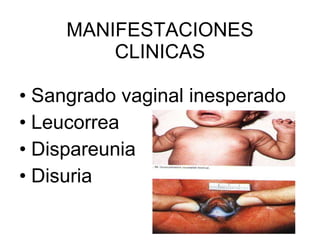 MANIFESTACIONES CLINICAS Sangrado vaginal inesperado Leucorrea Dispareunia Disuria 