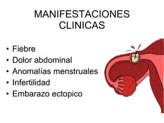 MANIFESTACIONES CLINICAS Fiebre Dolor abdominal Anomalías menstruales Infertilidad Embarazo ectopico 