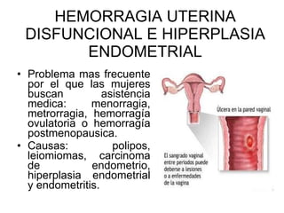 HEMORRAGIA UTERINA DISFUNCIONAL E HIPERPLASIA ENDOMETRIAL Problema mas frecuente por el que las mujeres buscan asistencia medica : menorragia, metrorragia, hemorragía ovulatoria o hemorragía postmenopausica. Causas: polipos, leiomiomas, carcinoma de endometrio, hiperplasia endometrial y endometritis. 