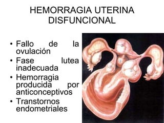 HEMORRAGIA UTERINA DISFUNCIONAL Fallo de la ovulación Fase lutea inadecuada Hemorragia producida por anticonceptivos Transtornos endometriales 
