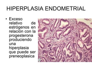 HIPERPLASIA ENDOMETRIAL Exceso relativo de estrógenos en relación con la progesterona produciendo una hiperplasia que puede ser preneoplasica 
