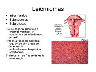 Leiomiomas Intramurales Submucosos Subserosos Puede llegar a adherirse a órganos vecinos , y convertirse en leiomiomas parasito. Presenta focos de necrosis isquemica con áreas de hemorragia, reblandecimiento quistico, calcificarse. El síntoma mas frecuente es la menorragia 