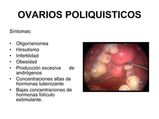 OVARIOS POLIQUISTICOS Síntomas:  Oligomenorrea Hirsutismo Infertilidad  Obesidad Producción excesiva  de andrógenos Concentraciones altas de hormonas luteinizante  Bajas concentraciones de hormonas folículo estimulante. 