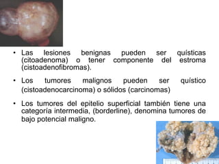 Las lesiones benignas pueden ser quísticas (citoadenoma) o tener componente del estroma (cistoadenofibromas). Los tumores malignos pueden ser quístico (cistoadenocarcinoma) o sólidos (carcinomas)   Los tumores del epitelio superficial también tiene una categoría intermedia, (borderline), denomina tumores de bajo potencial maligno.   