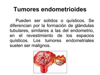 Tumores endometrioides Pueden ser solidos o quísticos. Se diferencian por la formación de glándulas tubulares, similares a las del endometrio, en el revestimiento de los espacios quísticos. Los tumores endometriales suelen ser malignos.  