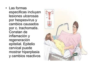 Las formas especificas incluyen lesiones ulcerosas por hespesvirus y cambios causados por c. trachomatis. Constan de inflamación y regeneración epitelial. Epitelio cervical puede mostrar hiperplasia y cambios reactivos 