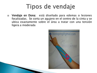  Vendaje en Dona: está diseñado para edemas o lesiones
focalizadas. Se corta un agujero en el centro de la cinta y se
ubica exactamente sobre el área a tratar con una tensión
ligera a moderada
 